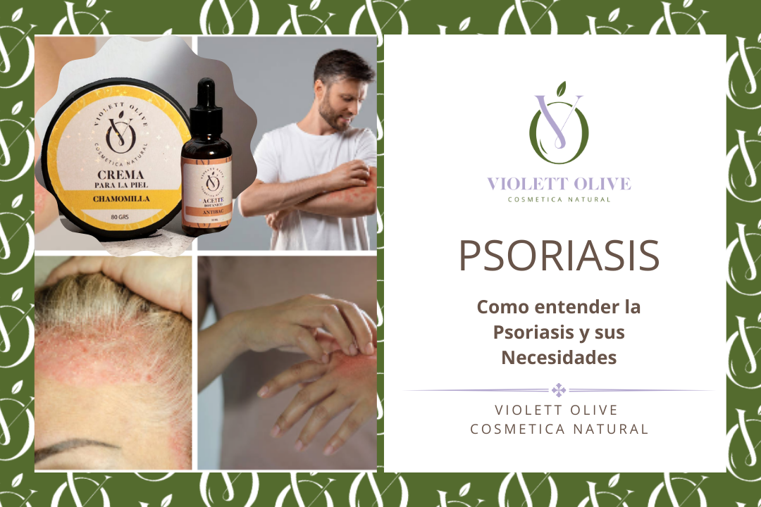 psoriasis cosmética natural