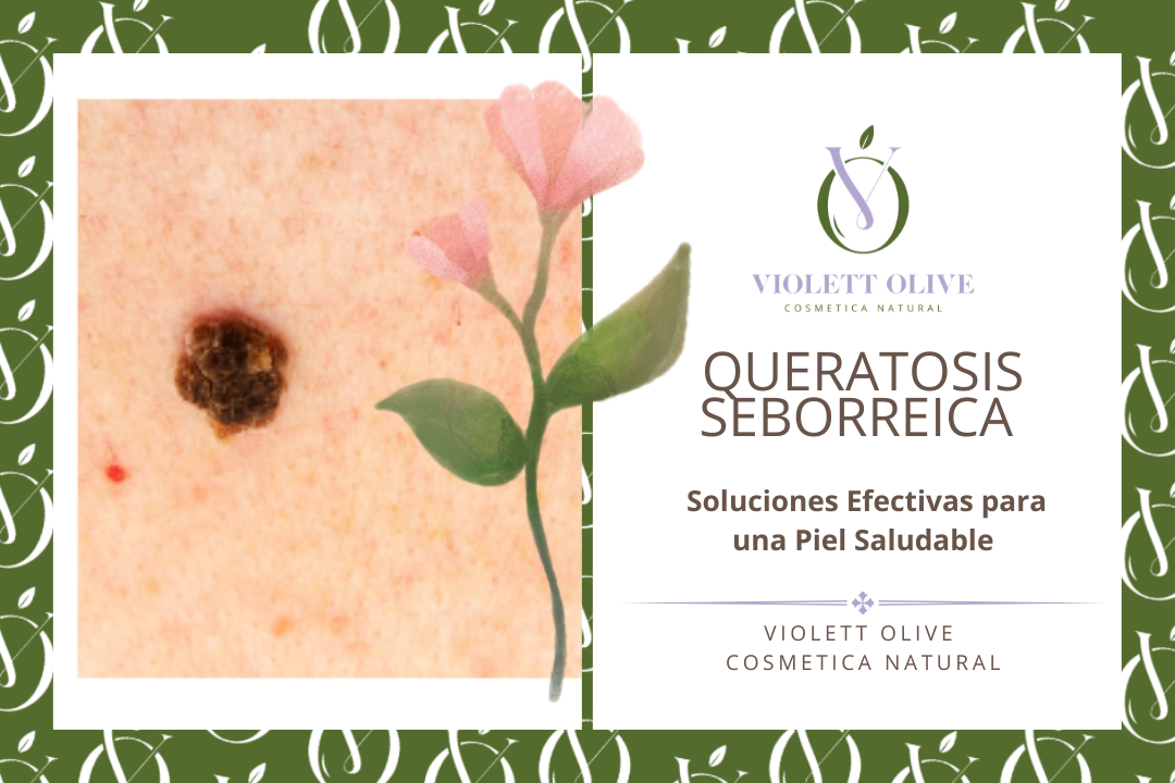 queratosis seborreica cosmética