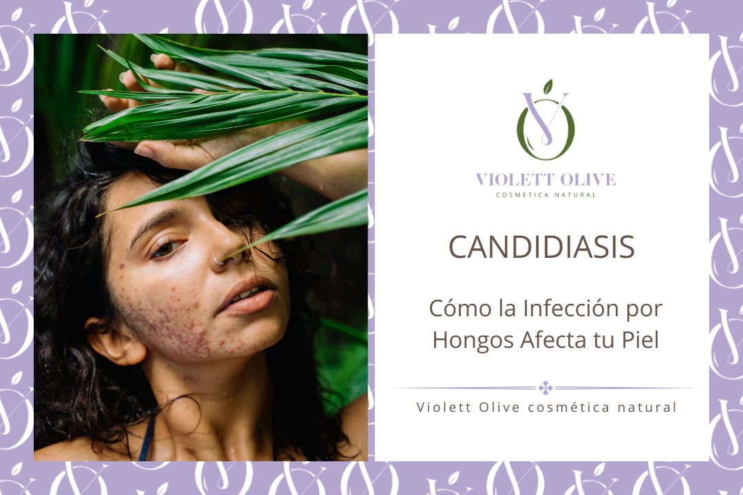 candidiasis problemas dermatologicos