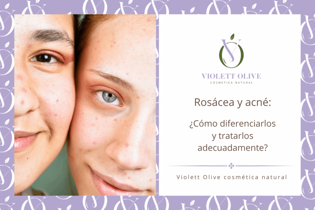 Rosácea y acné Violett Olive cosmetica natural