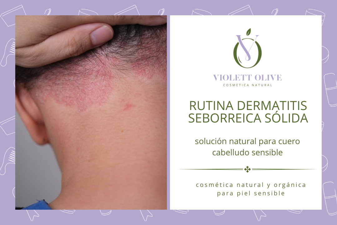 Rutina dermatitis natural